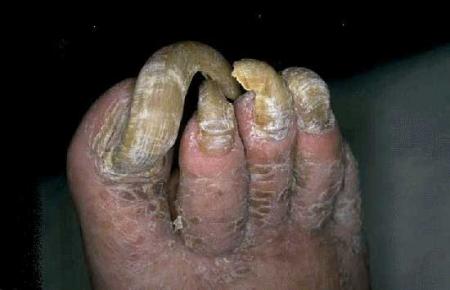 BEURKKKK  !!! C CRADE COMME MM